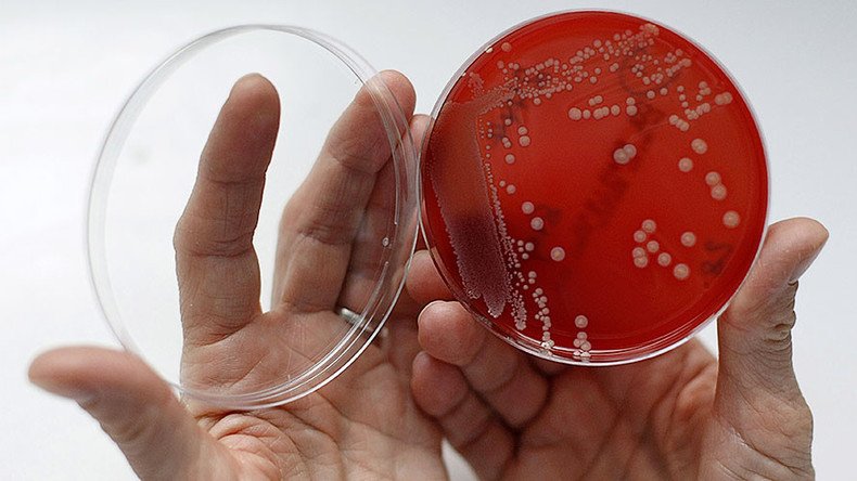 Drug-resistant superbug sent to space for study – NASA 