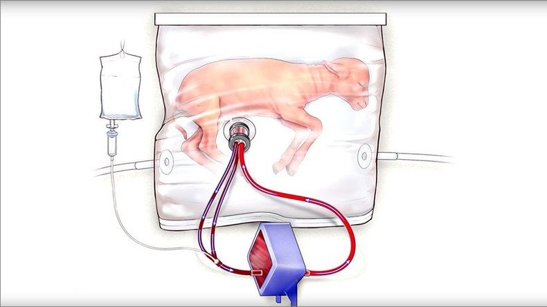 Artificial wombs successfully pass 1st test, human trials could begin within 3yrs (PHOTOS)