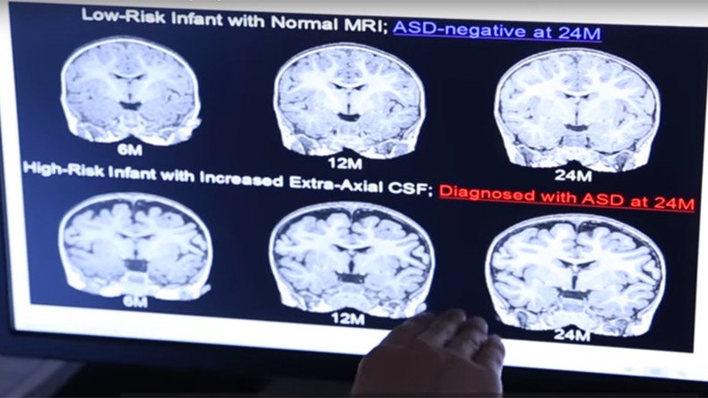AI machine can spot autism in babies as young as 6 months – study
