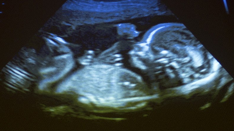 Babies drawn to face-like shapes while still in womb – study