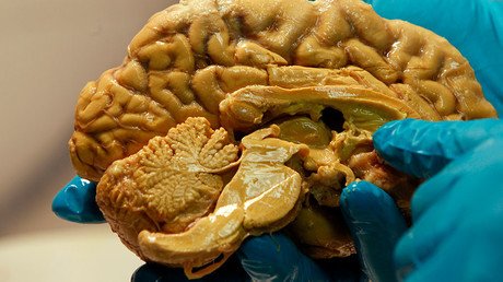 Diabetes drug tackles effects of Alzheimer’s in mice – study 