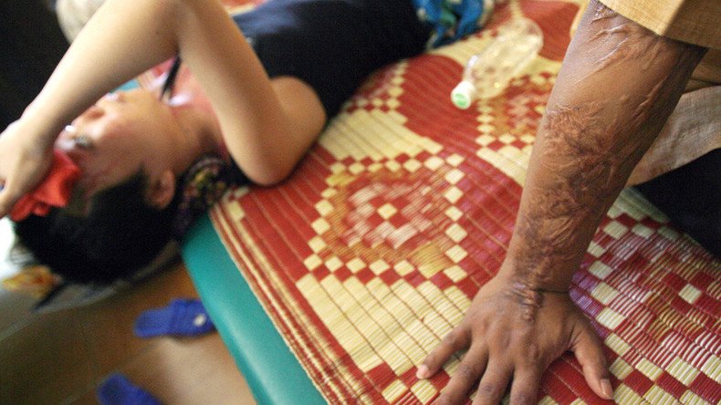 Indian authorities doubt story of woman who ‘suffered 5th acid attack’ despite police protection