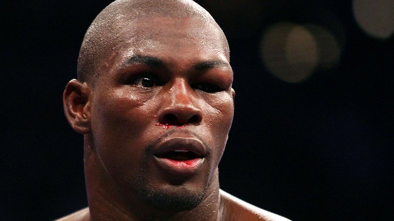 Former US boxing champion arrested for allegedly biting woman’s face