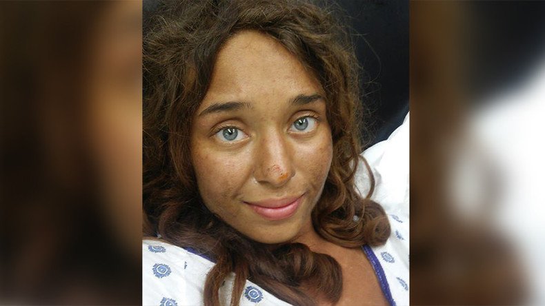 ‘Miracle’ woman survives in wilderness for 28 days, loses 50lb