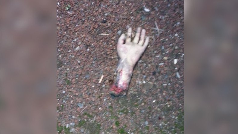‘A terror-wrist!’ Sightings of ‘severed hand’ shut major UK road
