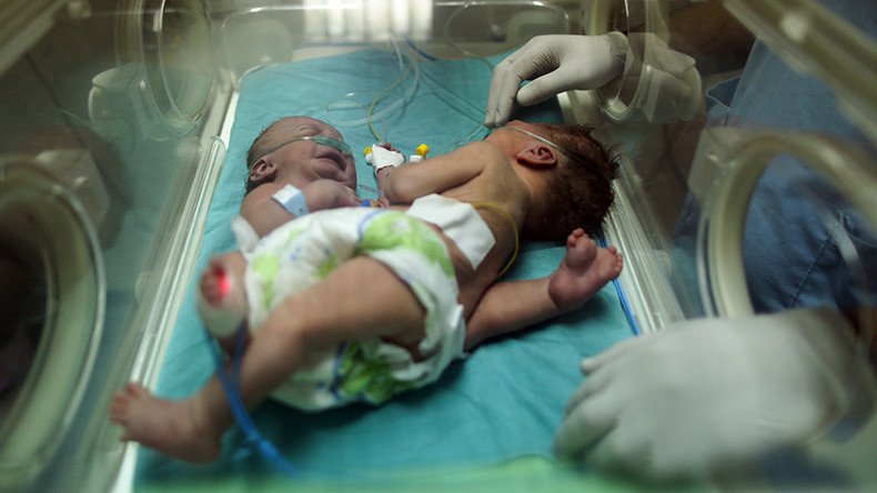 Conjoined twins relying on suspension of Gaza blockade to survive