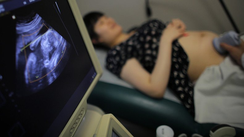 ‘Down Syndrome abortions’ set for ban after Ohio House vote