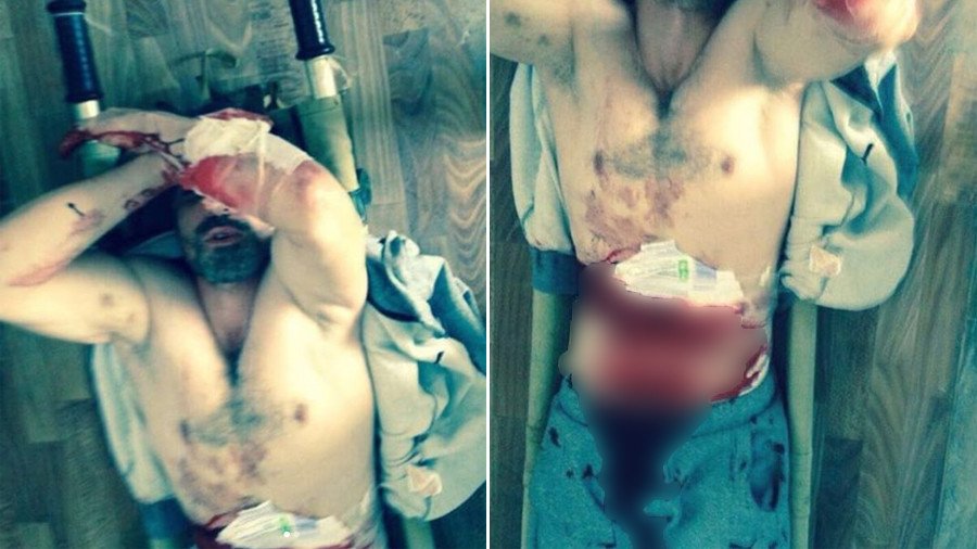 MMA fighter cuts own stomach & arm in detention (GRAPHIC VIDEO)