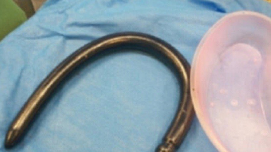 Doctors’ horror as 30-inch sex toy gets stuck inside man