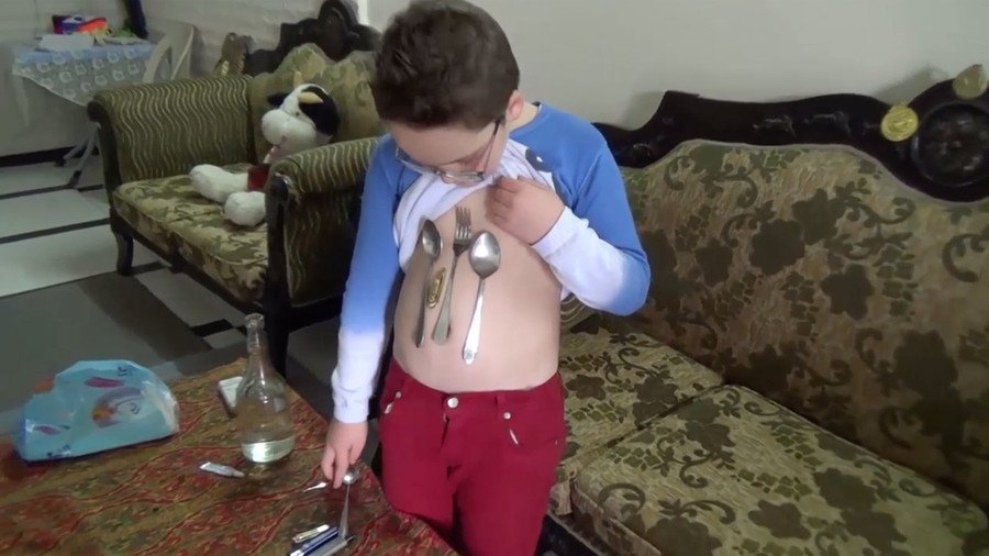 Real life ‘Magneto’? Metal sticks to stomach of Syrian boy in bizarre trick (VIDEO)