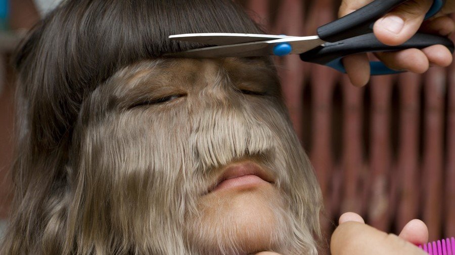 ‘World’s hairiest girl' shaves her face to marry love of her life