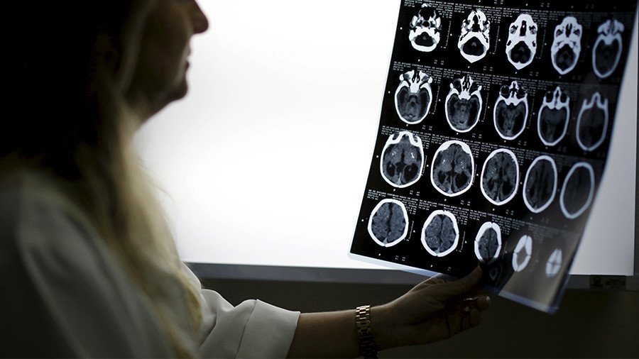 Woman’s brain leaked fluid for years after ‘allergy’ misdiagnosis (PHOTOS)