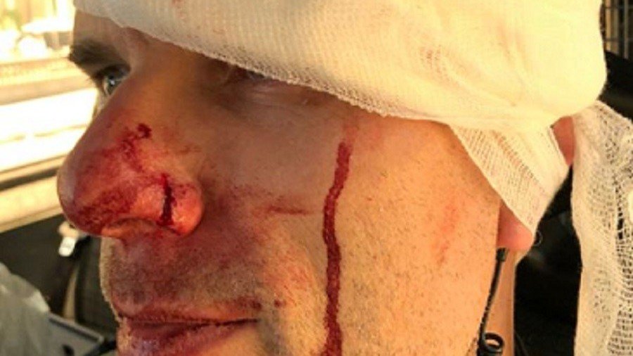 Officer hospitalized as Tommy Robinson supporters face-off with anti-fascists (PHOTOS)