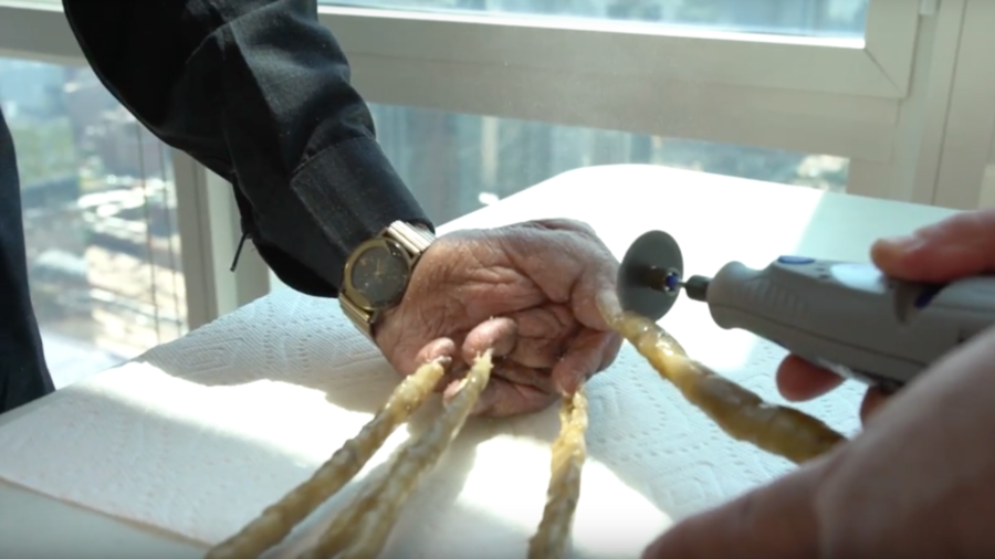 Indian man with world’s longest fingernails has them clipped & put on display in New York (VIDEO)