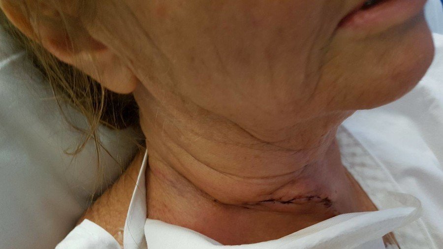 Woman lucky to survive after flying fish slits her throat (PHOTOS)