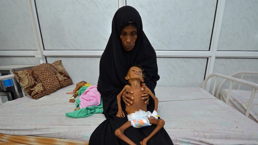 'Western-enabled Saudi behavior in Yemen would never survive due democratic scrutiny'