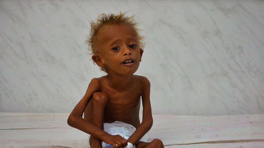 Half of Yemeni population survives on foreign aid – UN