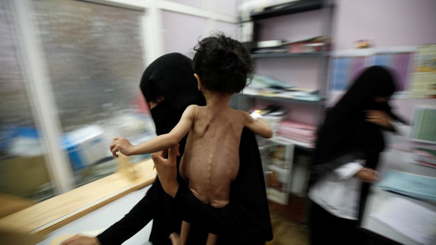 ‘Brutally honest’: Public outcry forces Facebook to stop banning pics of starving Yemeni girl