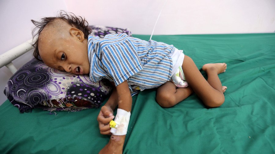 Saudi-led war in Yemen has left 85,000 children dead – report