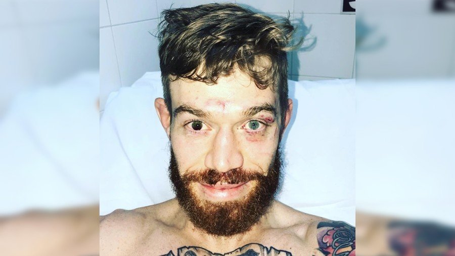 'Scariest injury': UFC fighter reveals horror eye damage suffered at Argentina event