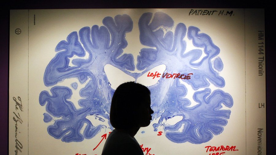 Not what you had in mind? Brain implant could help with depression, study says