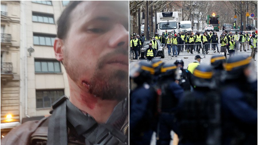 RT France reporter injured in the face as police tackle Yellow Vest protest in Paris