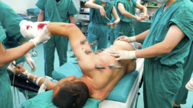 Man of steel: Chinese factory worker miraculously survives being impaled on spikes (GRAPHIC PHOTOS)