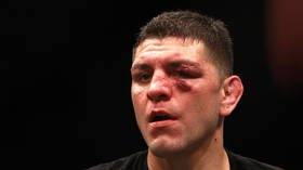 'Last time I checked he’s retired': Nick Diaz's fight career is over, says teammate