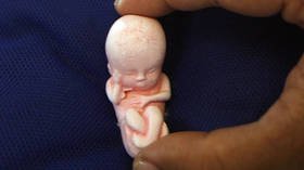 US court grants legal rights to aborted child as would-be father sues clinic on behalf of fetus