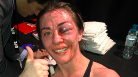 'You can beat your dreams if you don't stop': UFC fighter defies grisly facial injury to seal win