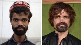 Tyrion Lannister doppelganger discovered working as waiter in Pakistan (PHOTOS)