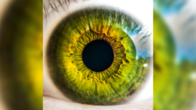 Ocular rift: GRAPHIC PHOTO shows what happens when your iris peels off
