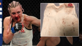 Russian UFC star Yana 'Foxy' Kunitskaya auctions 'sexy bloody shirt' to help autistic girl