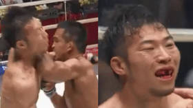 Dental damage: Watch as fighter knocks out FRONT TEETH of rival with brutal elbow (GRAPHIC)