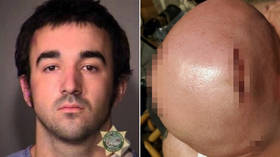 ‘Antifa fighter’ indicted for assault over Portland violence that savaged man’s scalp