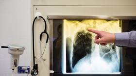 Over 100 infected as Tuberculosis OUTBREAK hits German school