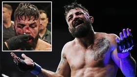 ‘He can smell around a corner!’ Mike Perry suffers badly broken nose at UFC Uruguay (GRAPHIC PHOTOS)