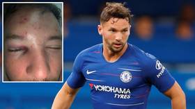 'She's coming home with me': England star Drinkwater left injured after nightclub love spat - report