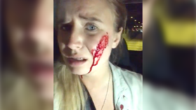 Hopping mad farmers ‘open fire’ on vegan activists who killed 100 rabbits at farm in Spain (VIDEO)