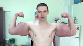 'Bazooka arms' MMA fighter Kirill Tereshin to undergo surgery to remove potentially deadly bicep enhancements