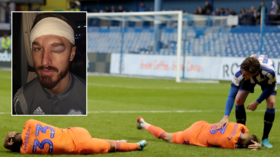 ‘Your head’s made of concrete!’: Footballer shows off horror hematoma after clashing with teammate