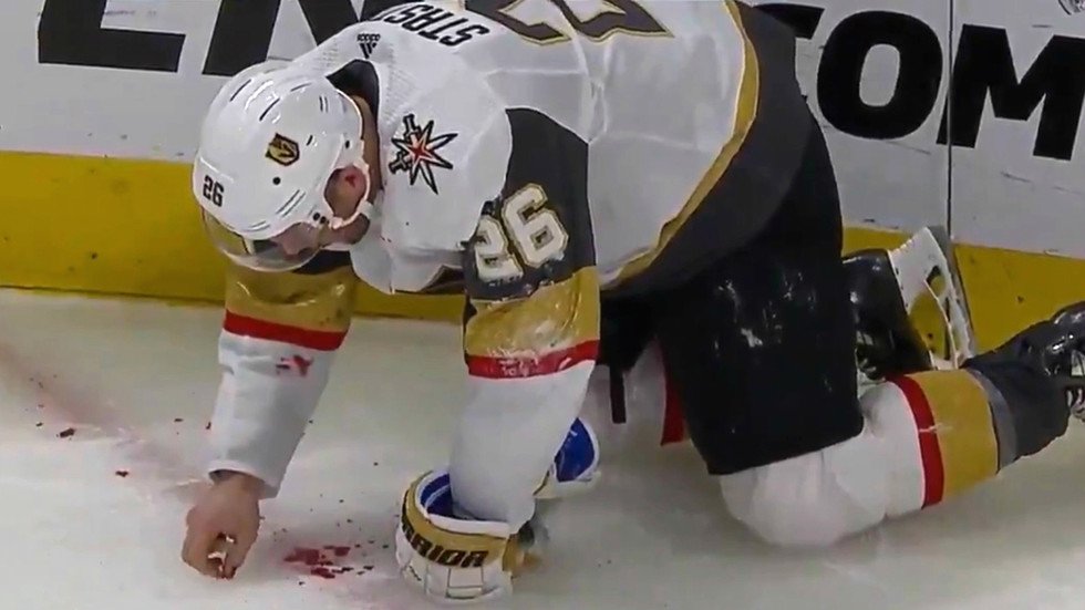 ‘He’s Picking Up His Teeth’: NHL Player Paul Stastny Drips Blood After ...