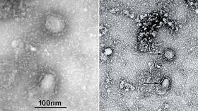 Chinese authorities share FIRST PHOTOS of deadly coronavirus