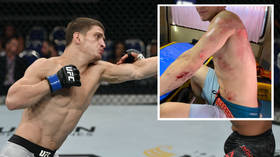 'That'll sting in the shower': Motorcycle smash leaves Russian UFC star Movsar Evloev injured and OUT of UFC 248 (GRAPHIC PHOTO)