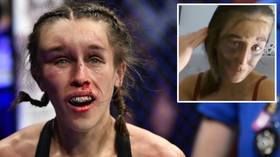 'So many bruises!' UFC star Joanna Jedrzejczyk shows off battle wounds after bruising encounter with Zhang Weili (VIDEO)