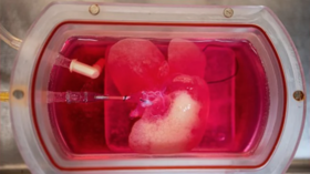Scientists SUCCESSFULLY transplant mini HUMAN livers into RATS