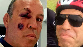 'I could have DIED': Bike-loving former MMA champ Wanderlei Silva survives AGAIN after being hospitalized by car crash in Brazil