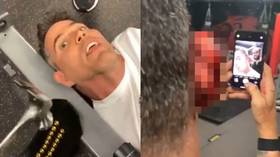 'I ripped half his ear off': UFC champion Jon Jones disfigures Jackass star Steve-O in DISTURBING VIDEO as stunt goes badly wrong