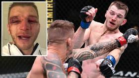 'That's the game we play': BATTERED Dan Hooker sends message to fans after CRAZY war with Dustin Poirier at UFC Vegas 4 (VIDEO)