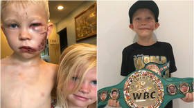 'The bravest man on earth': 6yo boy bitten in FACE by dog while shielding sister receives honorary World Champ belt